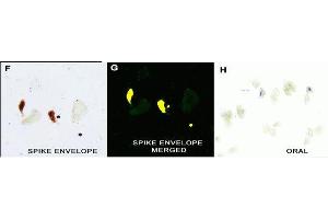 IHC Validation in COVID-19 Patient Sample: (Nuovo et al. (SARS-CoV-2 Envelope Antikörper  (N-Term))
