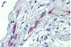 Lung, Human: Formalin-Fixed, Paraffin-Embedded (FFPE) (EHD4 Antikörper  (AA 396-445))