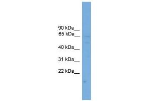 WB Suggested Anti-SOAT1 Antibody Titration:  0. (SOAT1 Antikörper  (Middle Region))