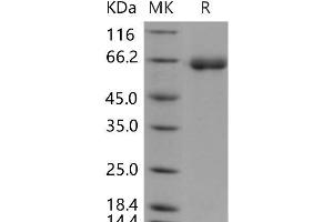 DPP7 Protein (His tag)