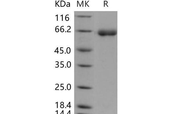 DPP7 Protein (His tag)