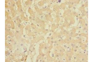 Immunohistochemistry of paraffin-embedded human liver tissue using ABIN7154473 at dilution of 1:100 (GADD45G Antikörper  (AA 1-159))