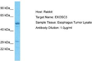 Host: Rabbit Target Name: EXOSC3 Sample Type: Esophagus Tumor lysates Antibody Dilution: 1. (EXOSC3 Antikörper  (C-Term))