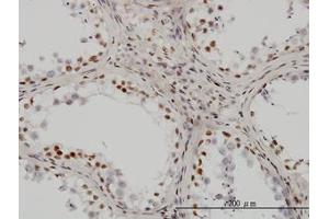 Image no. 3 for anti-Upstream Binding Transcription Factor, RNA Polymerase I (UBTF) (AA 551-651) antibody (ABIN599001) (UBTF Antikörper  (AA 551-651))