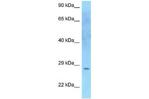 WB Suggested Anti-SOCS2 Antibody Titration: 1. (SOCS2 Antikörper  (C-Term))