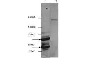 Western Blot of Rabbit anti-HDAC2 antibody. (HDAC2 Antikörper  (C-Term))