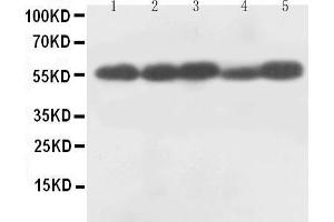 Western Blotting (WB) image for anti-Caspase 8 (CASP8) (AA 240-259), (Middle Region) antibody (ABIN3044361) (Caspase 8 Antikörper  (Middle Region))
