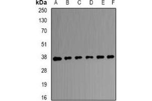 Western blot analysis of Transaldolase expression in HEK293T (A), A431 (B), SW480 (C), mouse brain (D), mouse kidney (E), rat liver (F) whole cell lysates. (TALDO1 Antikörper)