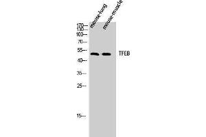 Western Blotting (WB) image for anti-Transcription Factor EB (TFEB) (N-Term) antibody (ABIN3177684) (TFEB Antikörper  (N-Term))
