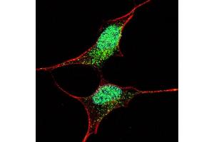 Fluorescent confocal image of SY5Y cells stained with (ABIN388789 and ABIN2839122) OCT4  antibody.