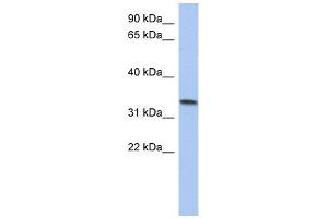 C10ORF96 antibody used at 1 ug/ml to detect target protein. (C10ORF96 Antikörper  (Middle Region))