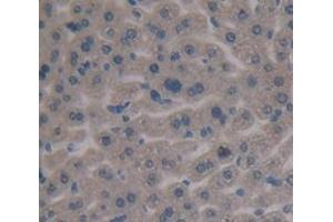 IHC-P analysis of Mouse Tissue, with DAB staining. (Fibronectin Antikörper  (AA 2117-2236))