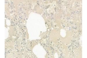 ABIN6257619 and ABIN6275298 at 1/100 staining human normal lung tissue by IHC-P.
