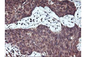 Image no. 5 for anti-Haloacid Dehalogenase-Like Hydrolase Domain Containing 1 (HDHD1) antibody (ABIN1498625) (HDHD1 Antikörper)