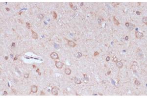 Immunohistochemistry of paraffin-embedded Rat brain using CARTPT Polyclonal Antibody at dilution of 1:100 (40x lens). (CARTPT Antikörper)