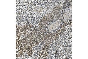 IHC analysis of HP1 alpha/CBX5 using anti-HP1 alpha/CBX5 antibody (ABIN7599058). (CBX5 Antikörper  (AA 1-191))