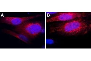 Expression of Thyrotropin-releasing hormone receptor 1 in mouse MS1 cellsImmunocytochemical staining of mouse pancreatic islet endothelial (MS1) cells. (TRHR Antikörper  (Intracellular))