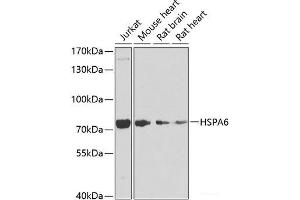 HSPA6 Antikörper