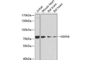 Western blot analysis of extracts of various cell lines using HSPA6 Polyclonal Antibody at dilution of 1:1000. (HSPA6 Antikörper)