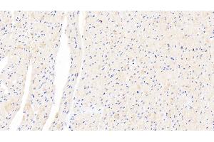 Detection of XRN1 in Human Cardiac Muscle Tissue using Polyclonal Antibody to 5'-3'Exoribonuclease 1 (XRN1) (XRN1 Antikörper  (AA 1394-1706))