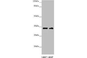 Western blot All lanes: CENPK antibody at 3. (CENPK Antikörper  (AA 1-269))
