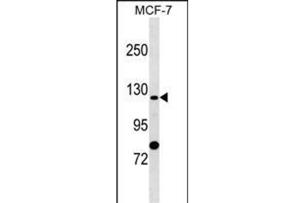 SLC4A9 Antikörper  (N-Term)