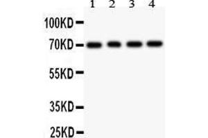 Anti- FOXO1A antibody, Western blotting All lanes: Anti FOXO1A  at 0. (FOXO1 Antikörper  (AA 456-655))