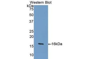Western blot analysis of the recombinant protein. (GDF5 Antikörper  (AA 382-501))