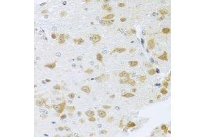 Immunohistochemistry of paraffin-embedded mouse brain using Gm13125 antibody. (Pramel15 Antikörper  (AA 67-274))