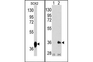 Western Blotting (WB) image for anti-SRY (Sex Determining Region Y)-Box 2 (SOX2) antibody (ABIN356387) (SOX2 Antikörper)