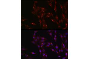 Immunofluorescence analysis of NIH/3T3 cells using MR1 Rabbit pAb (ABIN6131925, ABIN6143983, ABIN6143984 and ABIN6224070) at dilution of 1:100 (40x lens). (MR1 Antikörper  (AA 20-260))