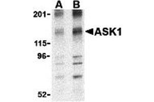 Western Blotting (WB) image for anti-Mitogen-Activated Protein Kinase Kinase Kinase 5 (MAP3K5) (N-Term) antibody (ABIN1031241) (ASK1 Antikörper  (N-Term))