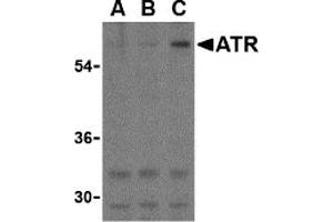 Western Blotting (WB) image for anti-ATR serine/threonine kinase (ATR) (C-Term) antibody (ABIN1030269) (ATR Antikörper  (C-Term))