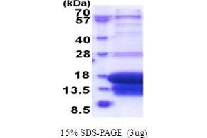 SDS-PAGE (SDS) image for Death-Associated Protein (DAP) (AA 1-102) protein (His tag) (ABIN6387467) (DAP Protein (AA 1-102) (His tag))