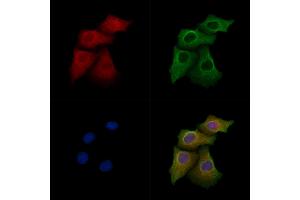 ABIN7094675 and ABIN7098726 staining Hela cells by IF/ICC.