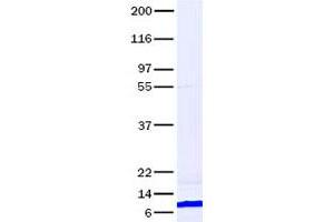 Validation with Western Blot (CCL22 Protein)
