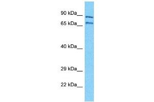 Western Blotting (WB) image for anti-Neuroblastoma Breakpoint Family, Member 11 (NBPF11) (Middle Region) antibody (ABIN2791692) (NBPF11 Antikörper  (Middle Region))