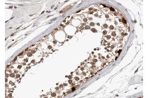ABIN6267348 at 1/100 staining human Testis tissue sections by IHC-P.