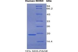 SDS-PAGE analysis of Human NOS3 Protein. (ENOS Protein)