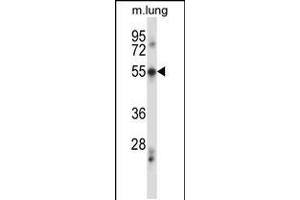 Western blot analysis in mouse lung tissue lysates (35ug/lane). (PDCD7 Antikörper  (C-Term))