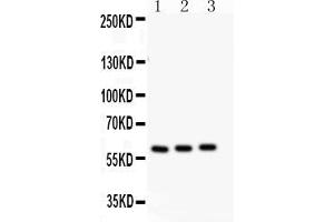 Western Blotting (WB) image for anti-Cytochrome P450, Family 11, Subfamily A, Polypeptide 1 (CYP11A1) (AA 53-66), (N-Term) antibody (ABIN5518682)