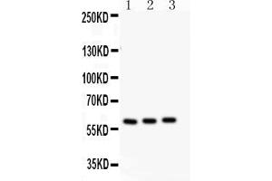 Anti-CYP11A1 antibody, Western blottingAll lanes: Anti CYP11A1  at 0. (CYP11A1 Antikörper  (N-Term))