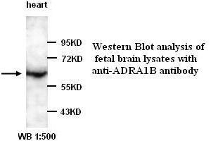 Image no. 1 for anti-Adrenergic, alpha-1B-, Receptor (ADRA1B) antibody (ABIN790879) (ADRA1B Antikörper)