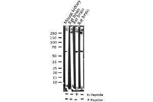 Western blot analysis of Phospho-Myc (Thr58) expression in various lysates (c-MYC Antikörper  (pThr58))