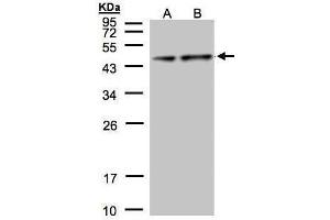 WB Image Sample(30 μg of whole cell lysate) A:Hep G2, B:MOLT4, 12% SDS PAGE antibody diluted at 1:1000