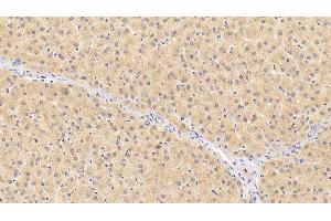 Detection of F12 in Human Liver Tissue using Polyclonal Antibody to Coagulation Factor XII (F12) (F12 Antikörper  (AA 400-615))