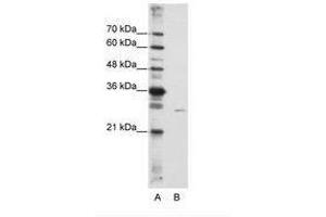 Image no. 2 for anti-EMG1 Nucleolar Protein Homolog (EMG1) (AA 51-100) antibody (ABIN6736233) (EMG1 Antikörper  (AA 51-100))