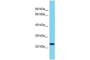 Host: Rabbit Target Name: IL34 Sample Type: U937 Whole Cell lysates Antibody Dilution: 1. (IL-34 Antikörper  (N-Term))