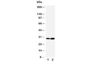 Western blot testing of LASP1 antibody and Lane 1:  HeLa (LASP1 Antikörper  (C-Term))