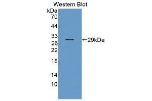 Detection of Recombinant LOX1, Bovine using Polyclonal Antibody to Lectin Like Oxidized Low Density Lipoprotein Receptor 1 (LOX1)